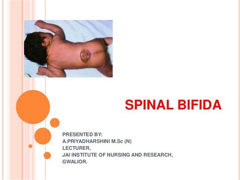 presentation of spina bifida